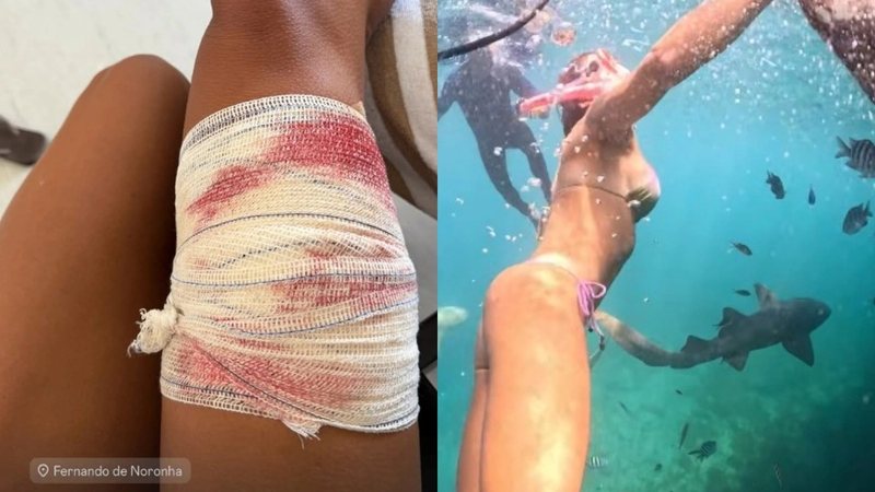 Advogada é mordida por tubarão durante mergulho em Fernando de Noronha