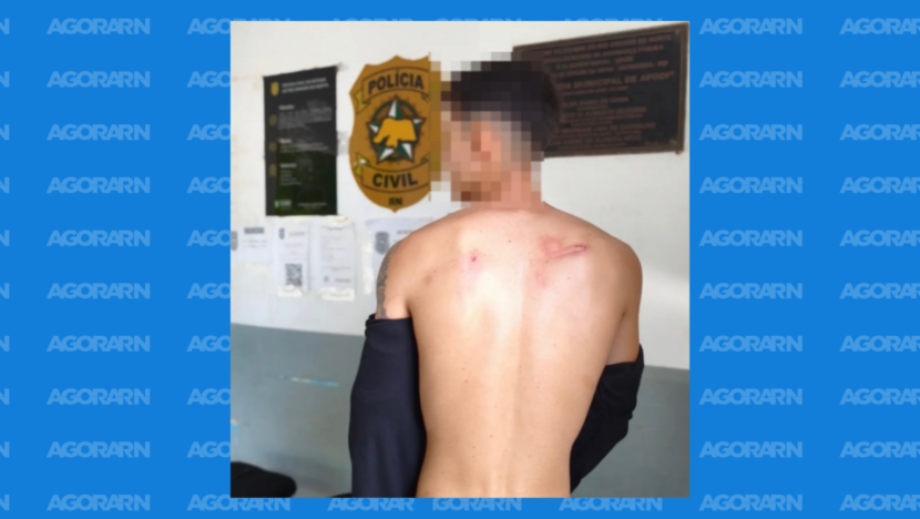 Outra vítima procura Polícia e denuncia seguranças por agressão durante Carnaval de Apodi