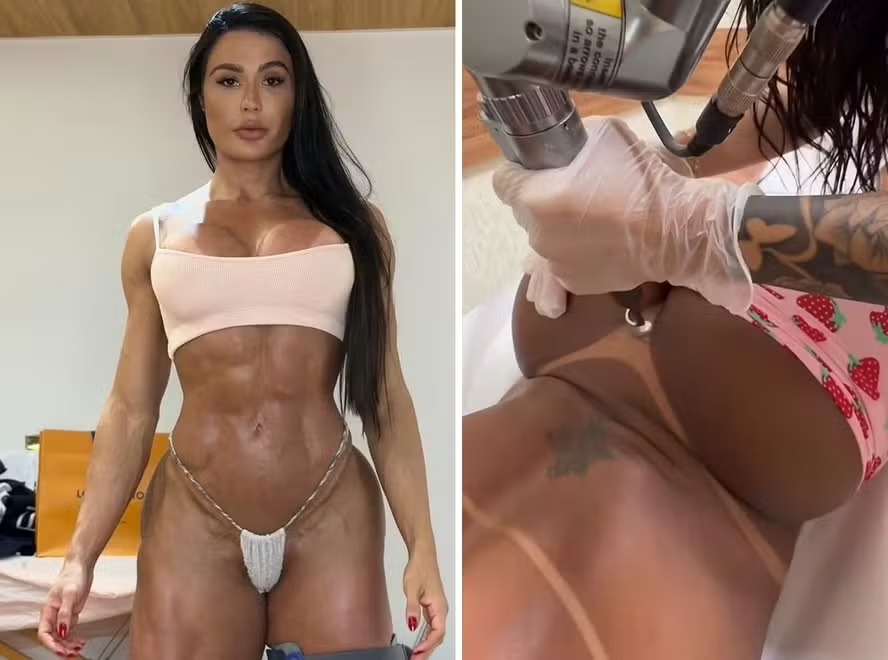 Gracyanne Barbosa apaga tatuagem íntima com nome de Belo