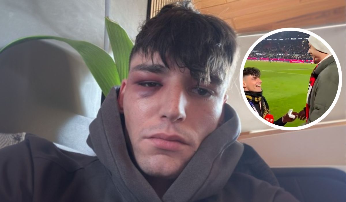 Árbitro sofre agressão brutal após pedir namorado em casamento na Alemanha