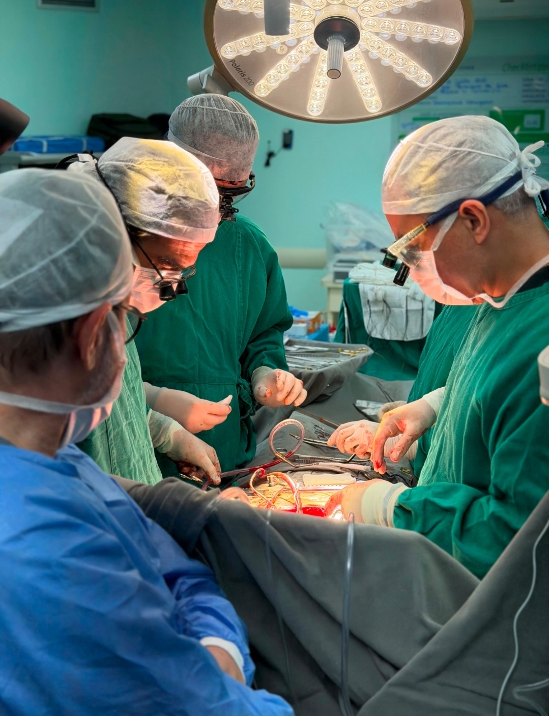 Transplante de coração é realizado com sucesso em Natal e paciente segue em UTI cardiológica