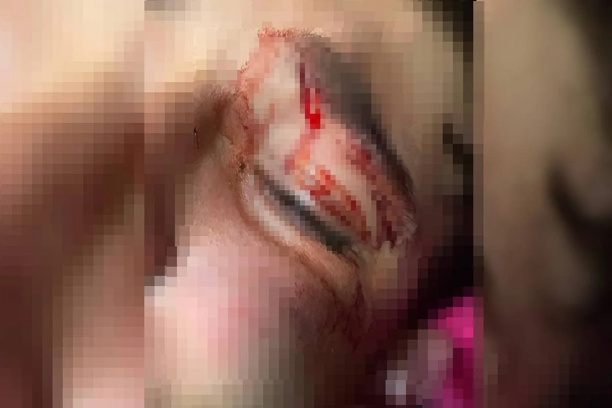 Mãe relata terror de adolescente espancado por PM em Goiás