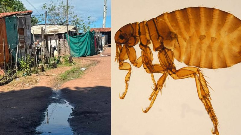 Surto de bicho-de-pé em Natal afeta cerca de 100 crianças em comunidade da Zona Norte