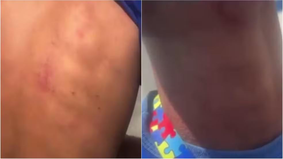 PMRN afasta policiais após agressão contra jovem com TEA em Macau