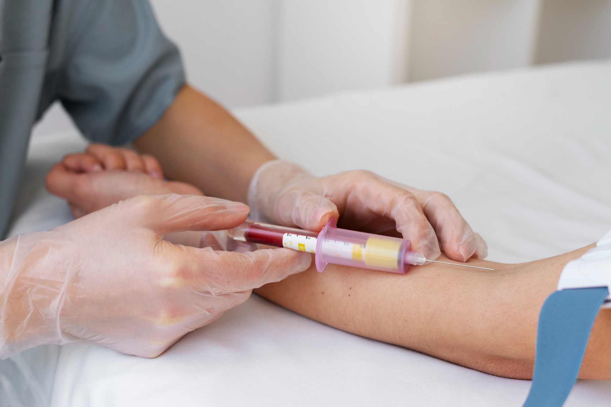 Exame de sangue pode prever risco de câncer de pulmão até 5 anos antes do diagnóstico