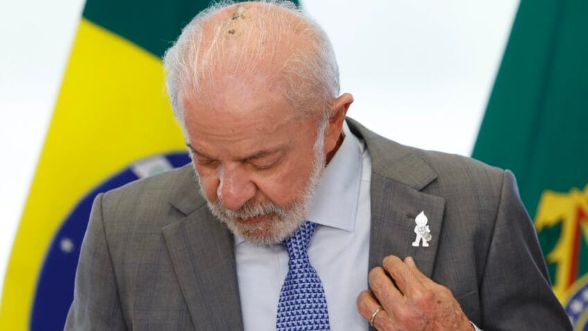 Presidente Lula inicia 15 sessões de radioterapia preventiva após retirada de lesão basocelular