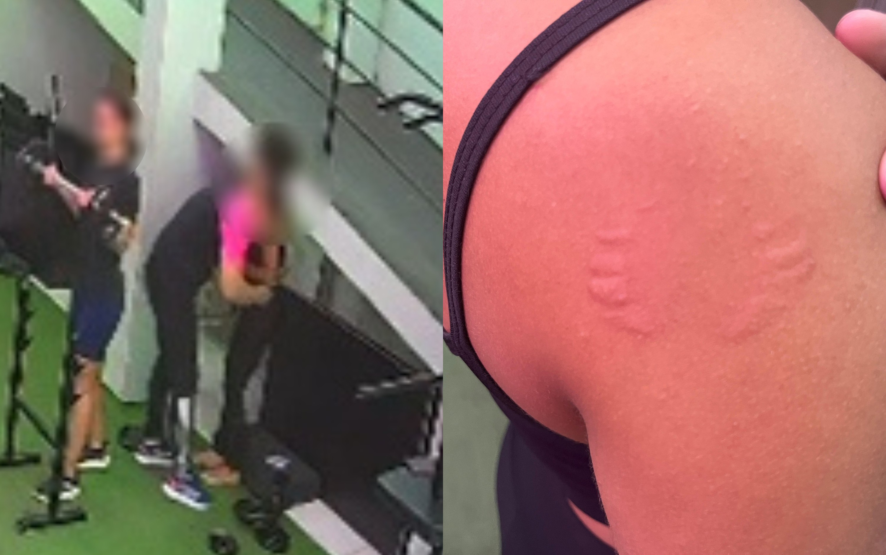 Professora denuncia assédio após ser agarrada e mordida por instrutor na Academia ElevaFit