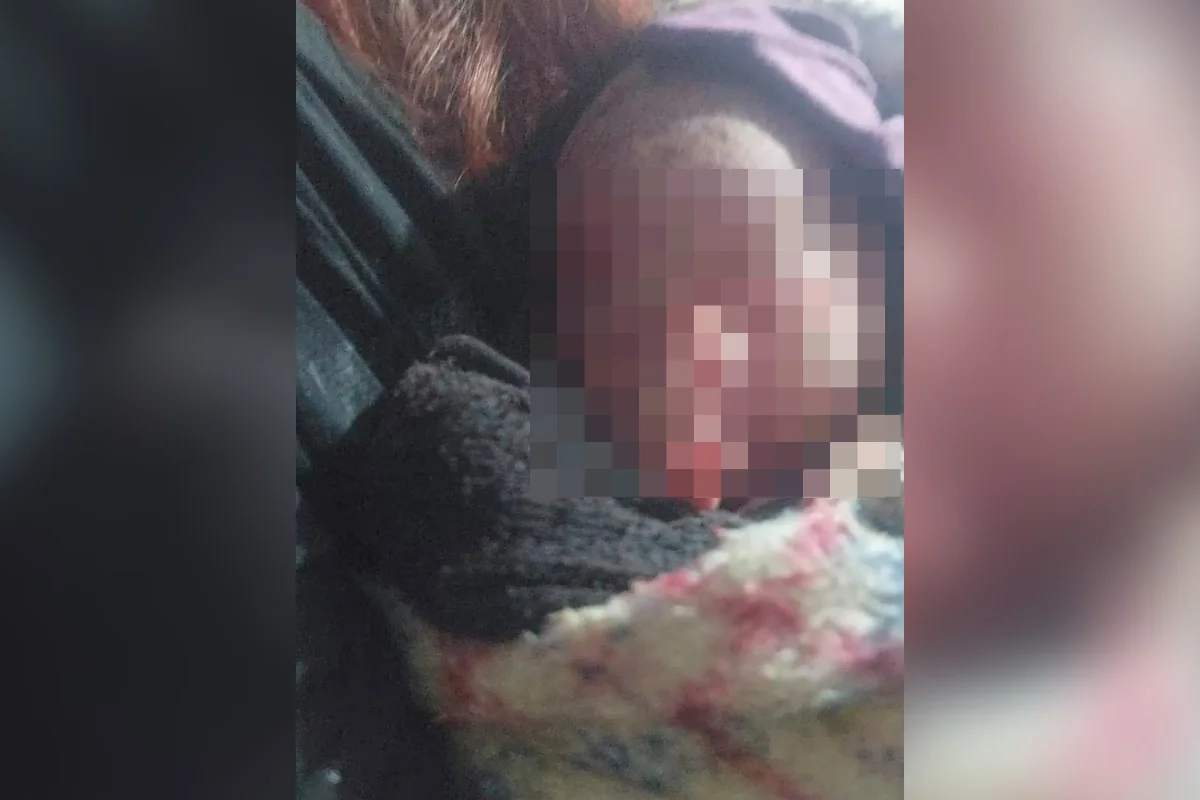 Recém-nascida é encontrada em saco de lixo na madrugada de segunda-feira