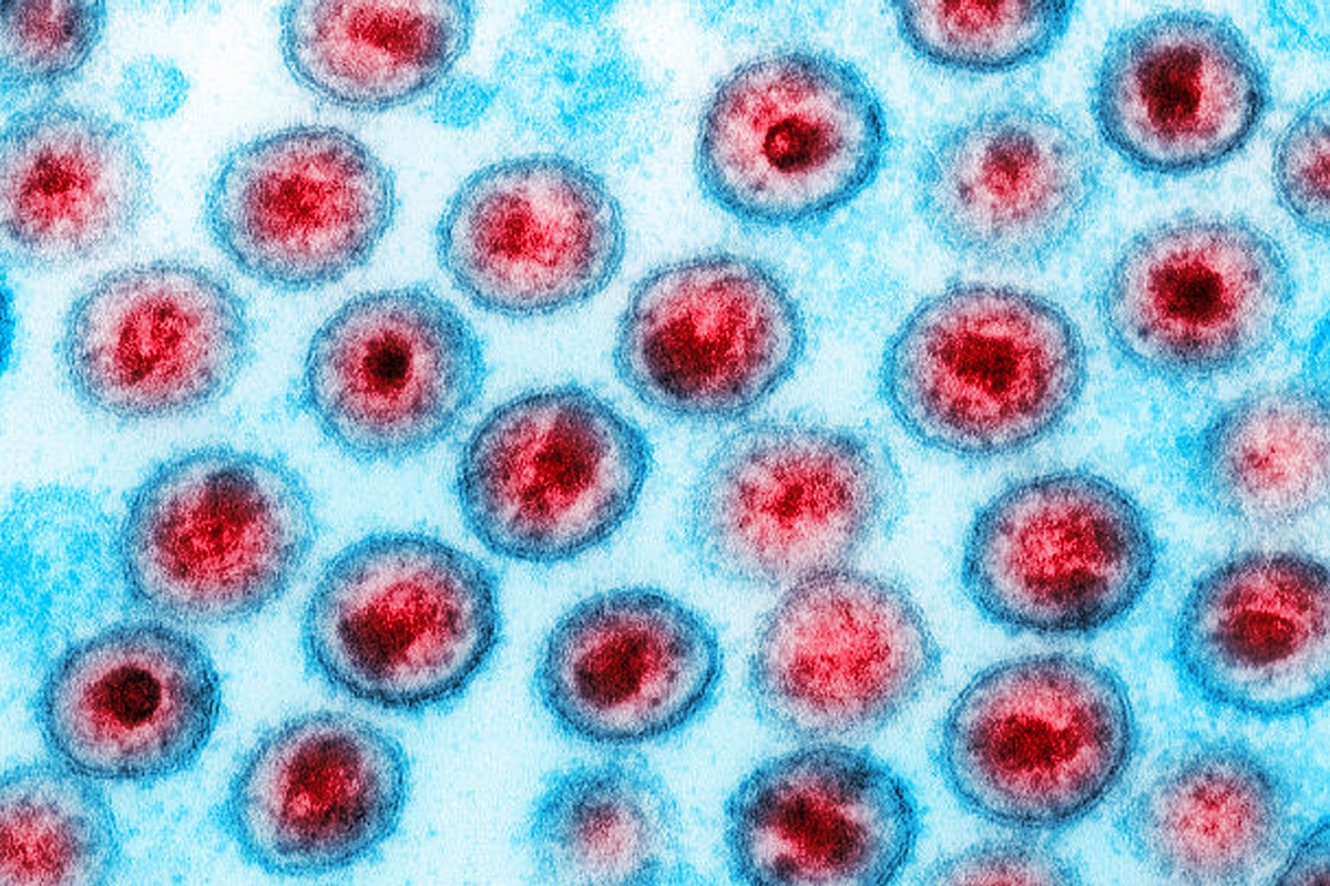Nature Microbiology relata 6º caso de remissão do HIV no mundo