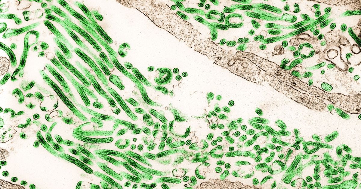 Ministério da Saúde investiga suspeita de Ebola em paciente com quadro grave vindo do Congo