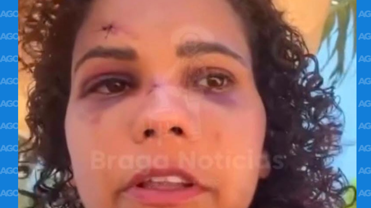 Turista é ferida ao reagir a tentativa de estupro em Touros