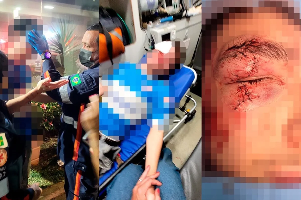 Jovem é desfigurado em ataque em Águas Claras e autor é liberado