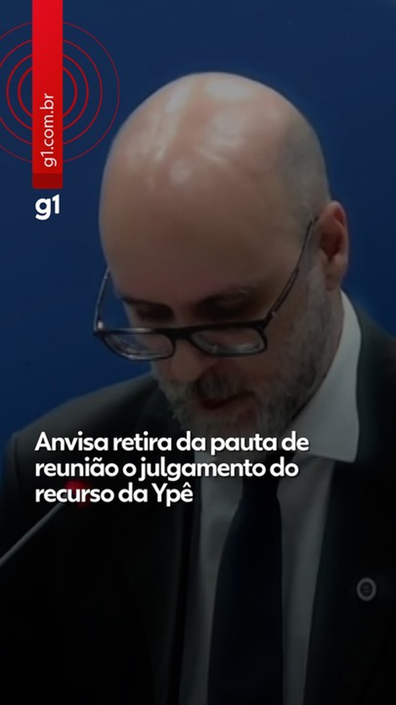 Anvisa revela contaminação grave em itens da Ypê