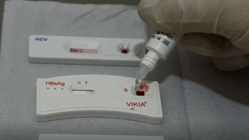 Brasil celebra marco histórico com redução de 29% nas novas infecções por HIV em 2025