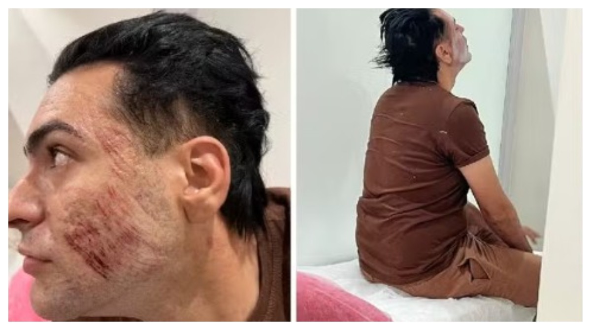 CFM regulamenta uso médico de fenol enquanto Anvisa mantém proibição estética