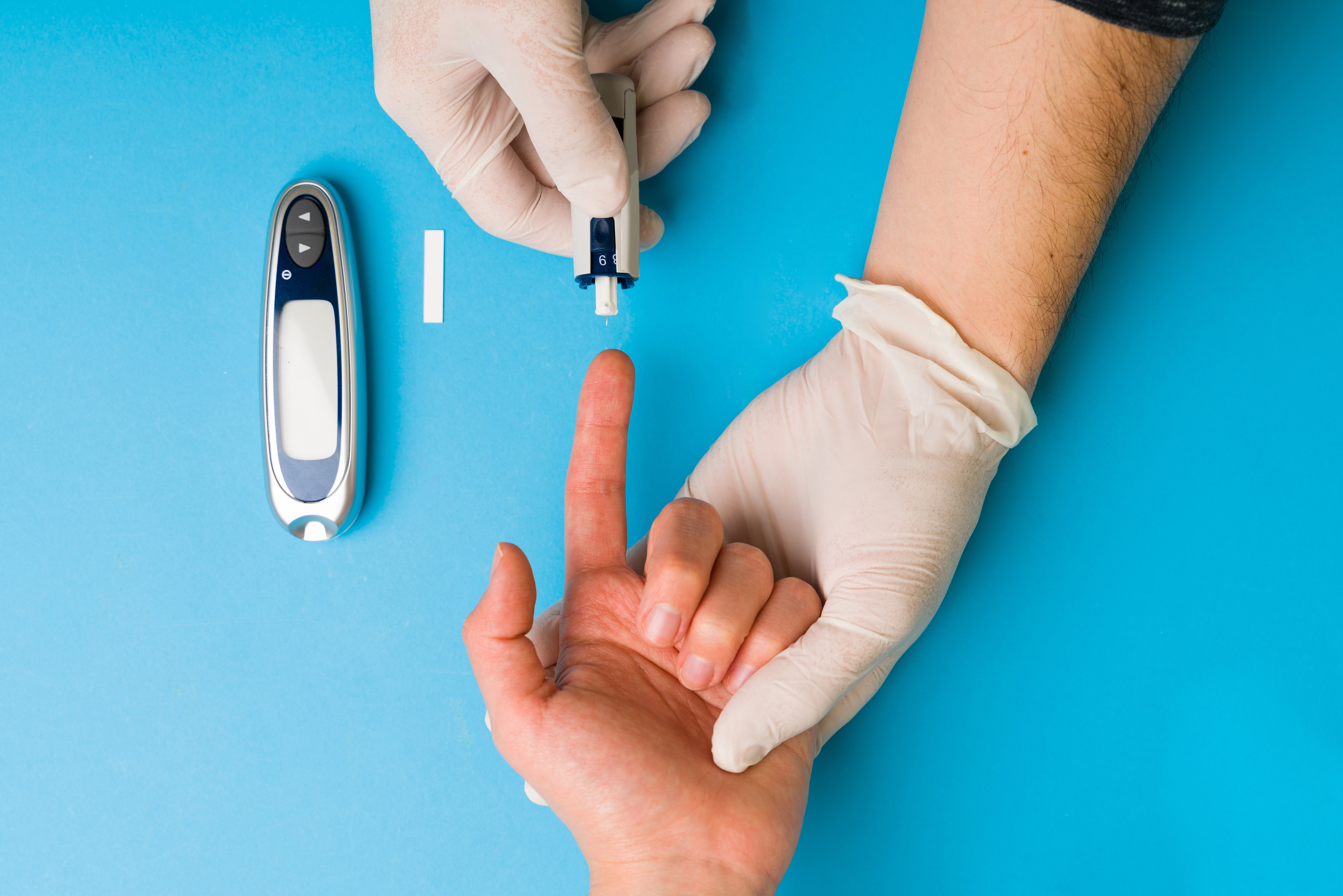 Cirurgia metabólica, versão da bariátrica, trata diabetes tipo 2 e controla a doença em até 89% dos casos