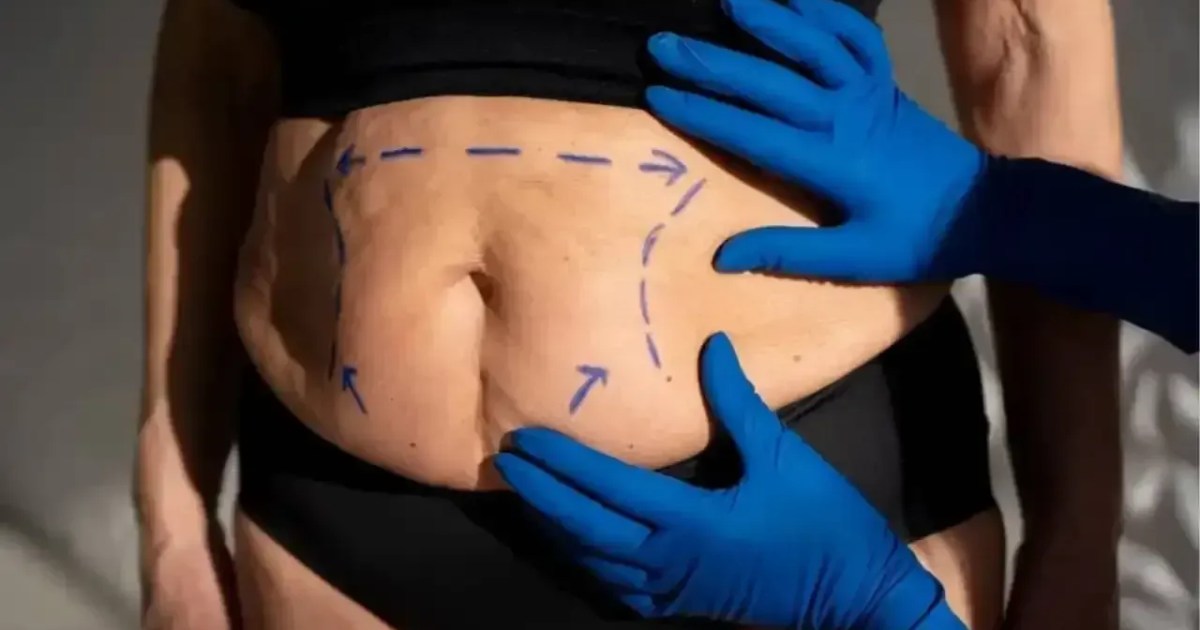 Cirurgia plástica melhora a autoestima? Dr. Dallegrave explica limites