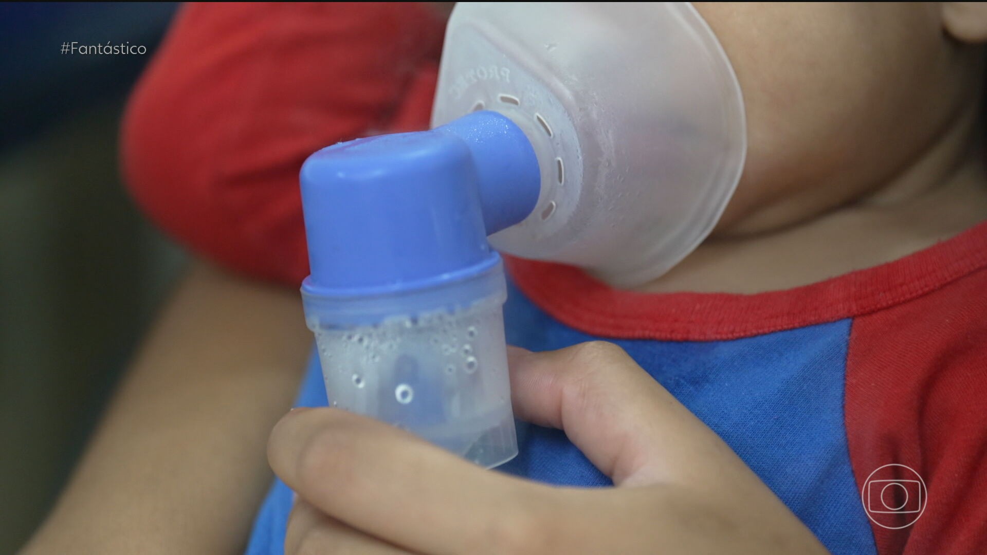Bronquiolite: Coriza de bebê pode evoluir para UTI, alertam médicos e pais