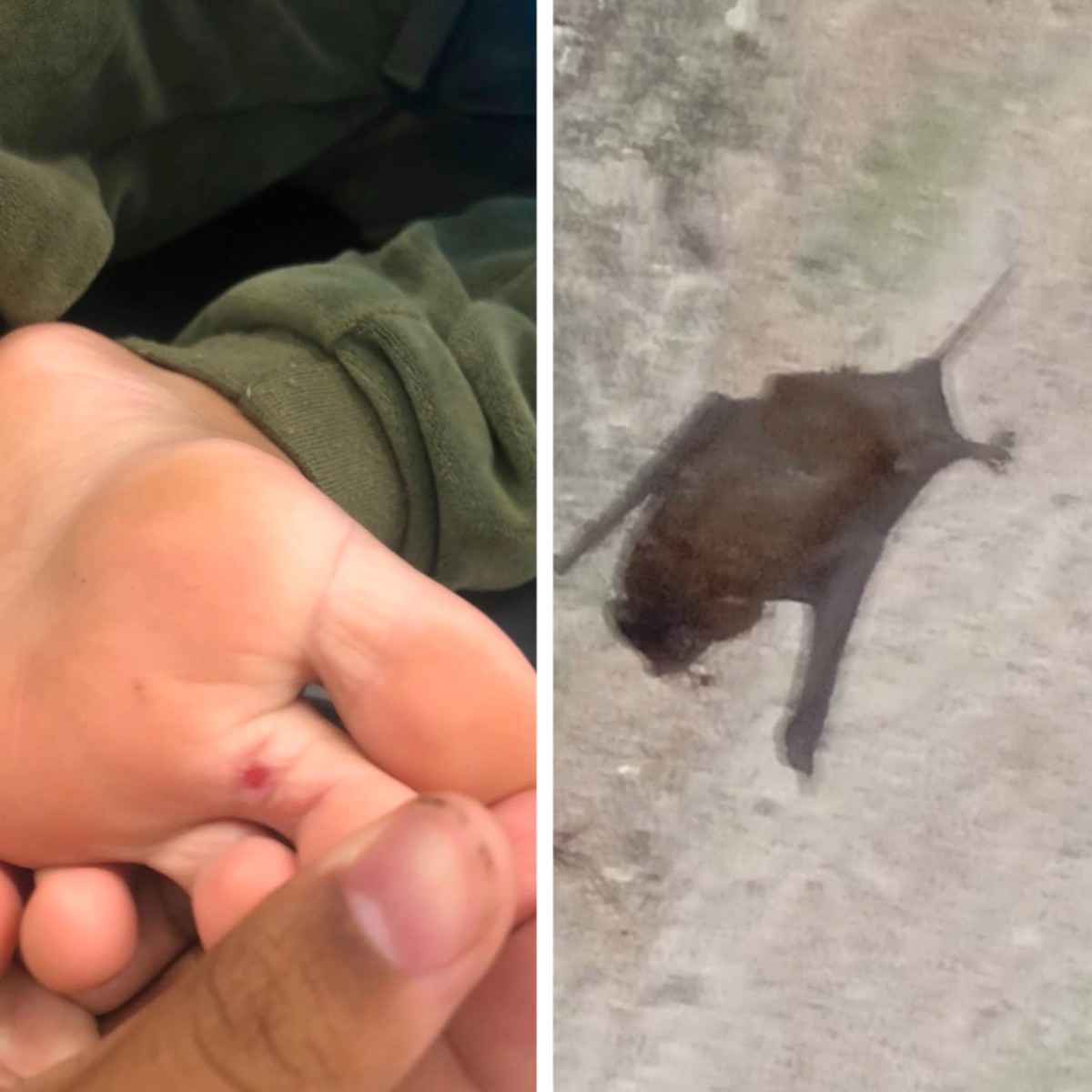 Criança é picada por morcego dentro de sapato em Betim