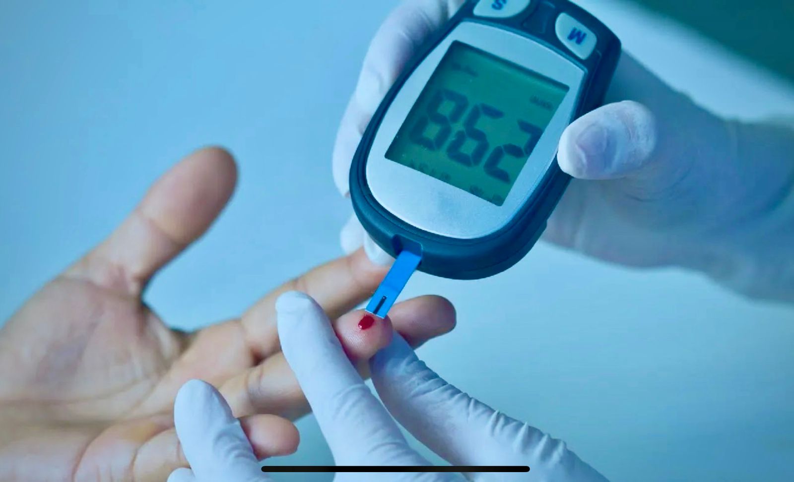 UFRN revoluciona controle da glicemia com tamarindo