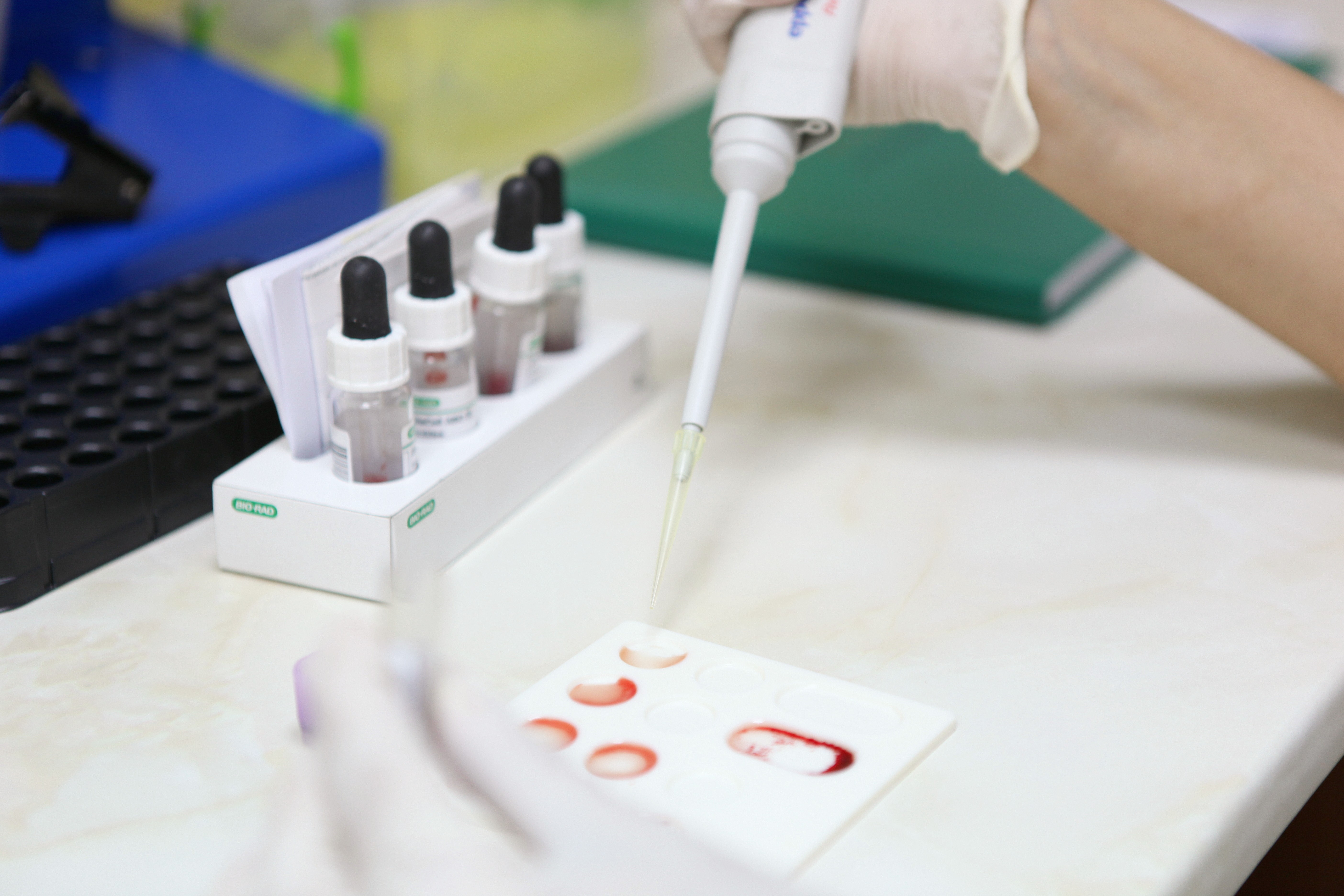 Exame de sangue para Alzheimer detecta sinais anos antes dos sintomas, aponta estudo