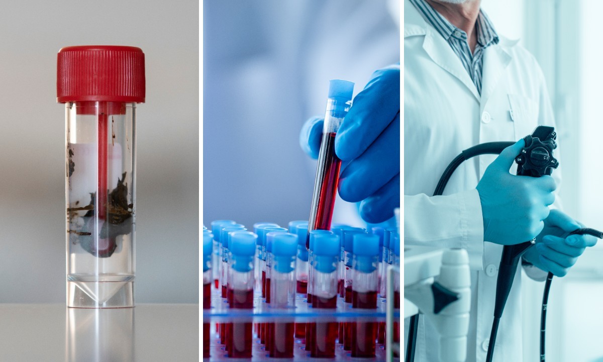 Sociedade Americana do Câncer atualiza diretrizes e inclui exames de fezes e sangue para rastreamento de câncer colorretal