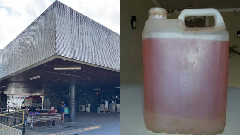 Criança de 11 anos sofre queimaduras graves em acidente doméstico no RN