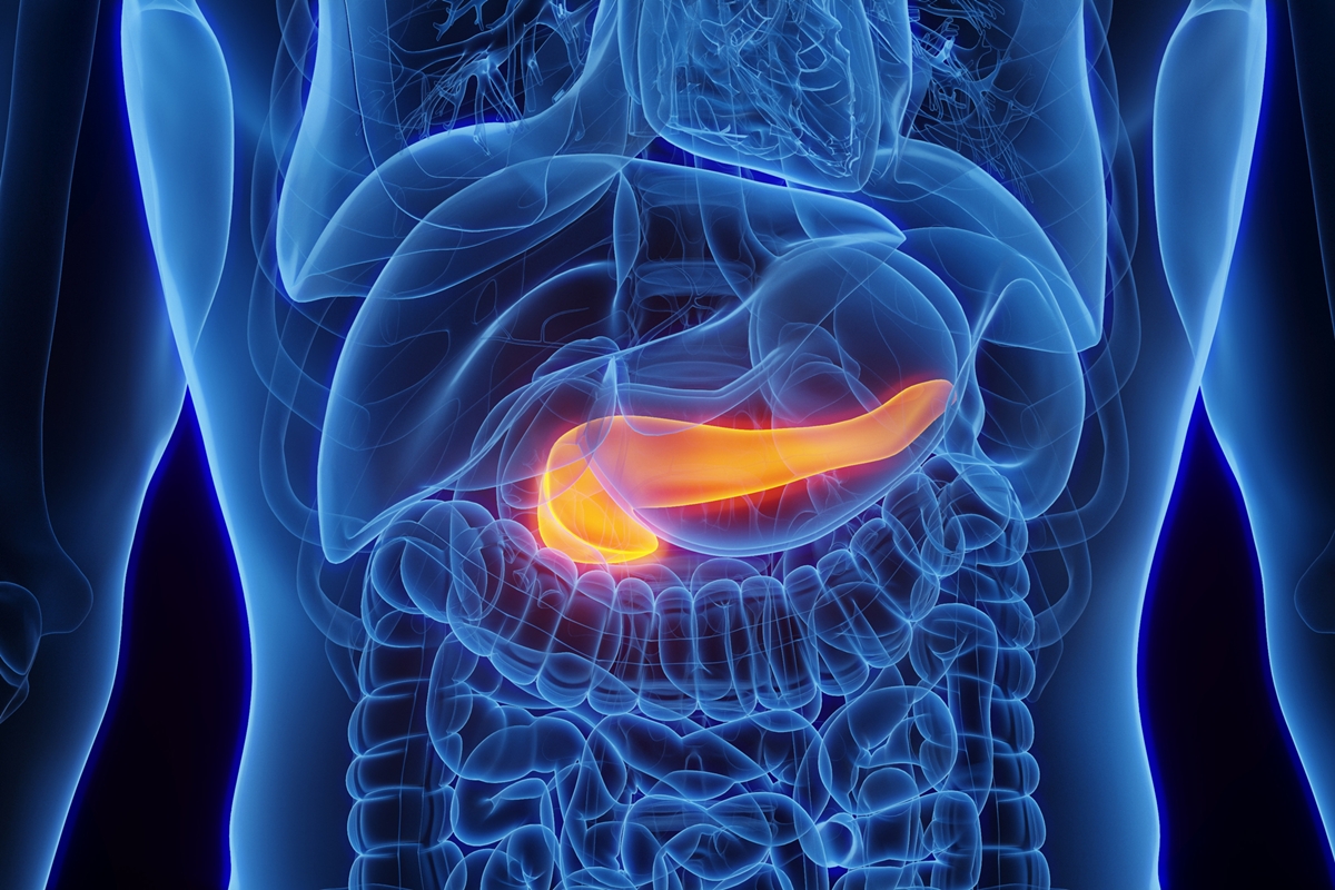 Pesquisa desvenda elo entre genes, obesidade e câncer de pâncreas