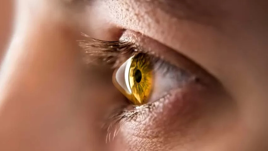 Glaucoma avança de forma silenciosa e pode causar cegueira, alertam especialistas - Portal 98 FM Natal
