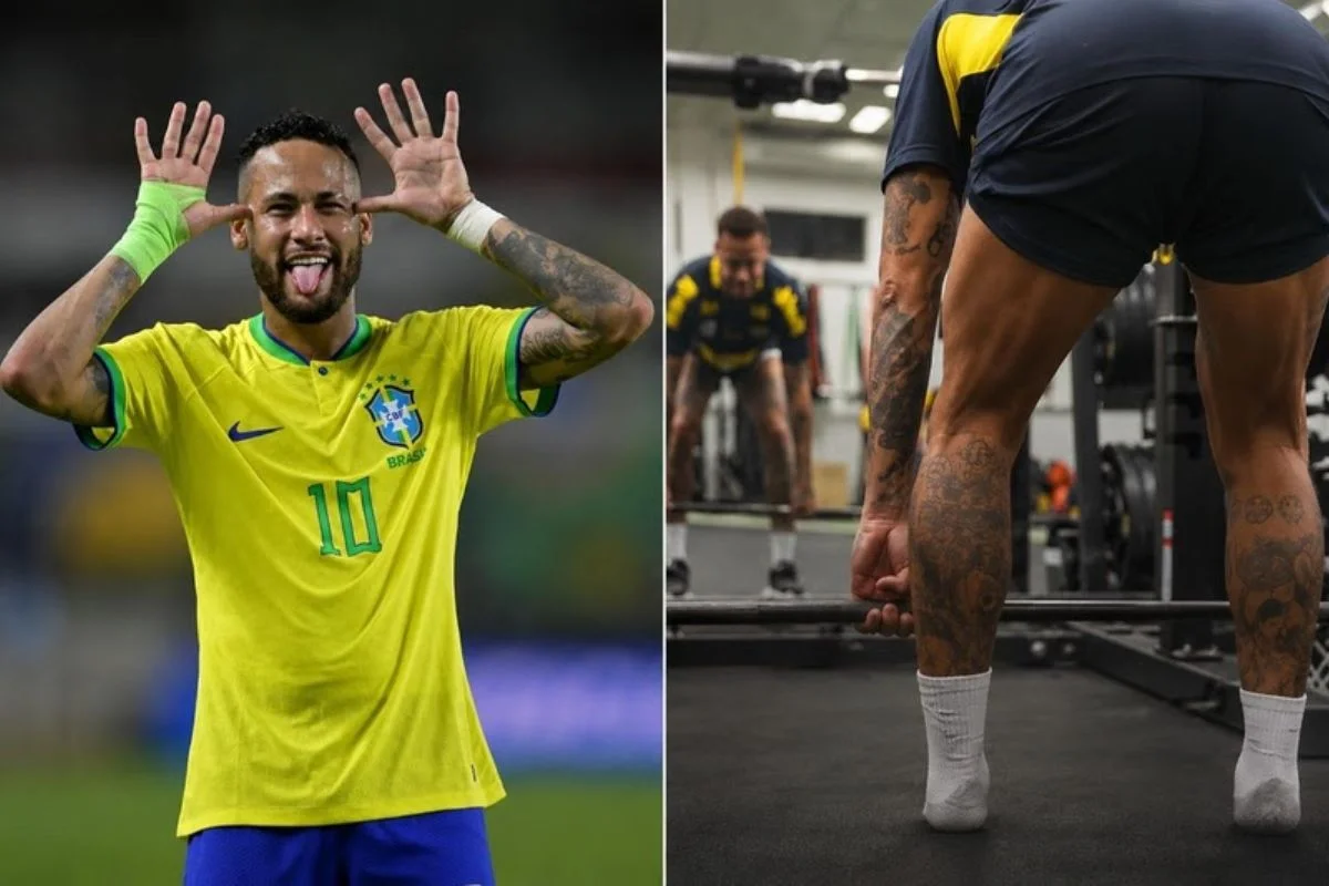 Harmonização glútea busca "bumbum de jogador" mas exige alinhamento de expectativas