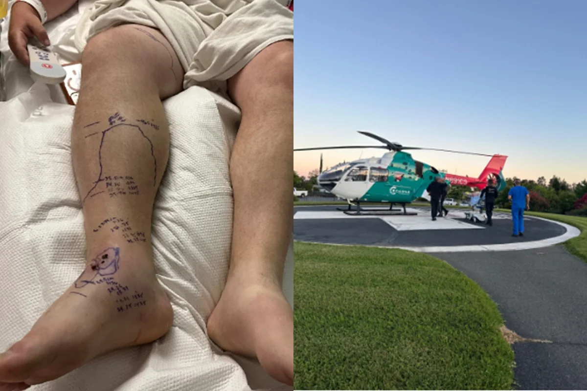 Homem sobrevive após ser picado por cascavel e esgotar estoque de soro em hospital