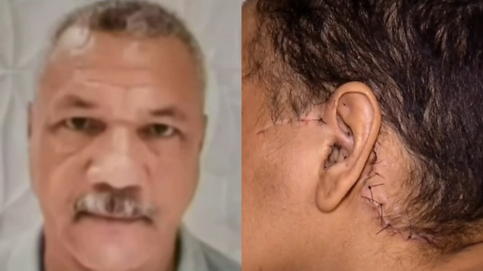 Homem que esfaqueou e decepou orelha de ex será julgado em Fortaleza