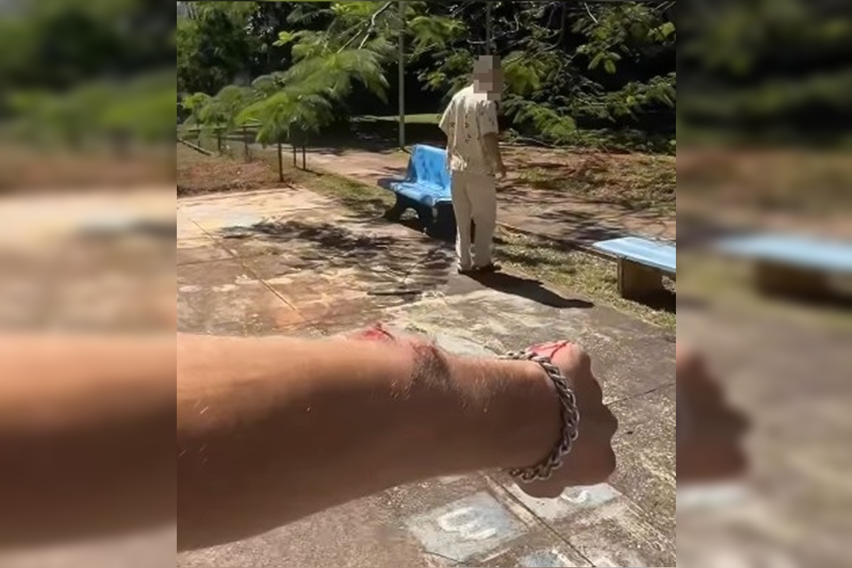 Homem relata ter braço quebrado após defender mulher no DF