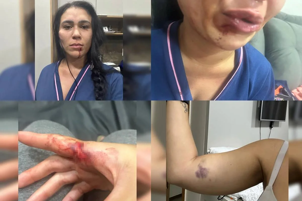 Justiça do Distrito Federal desclassifica tentativa de feminicídio de Jéssica Cytrus