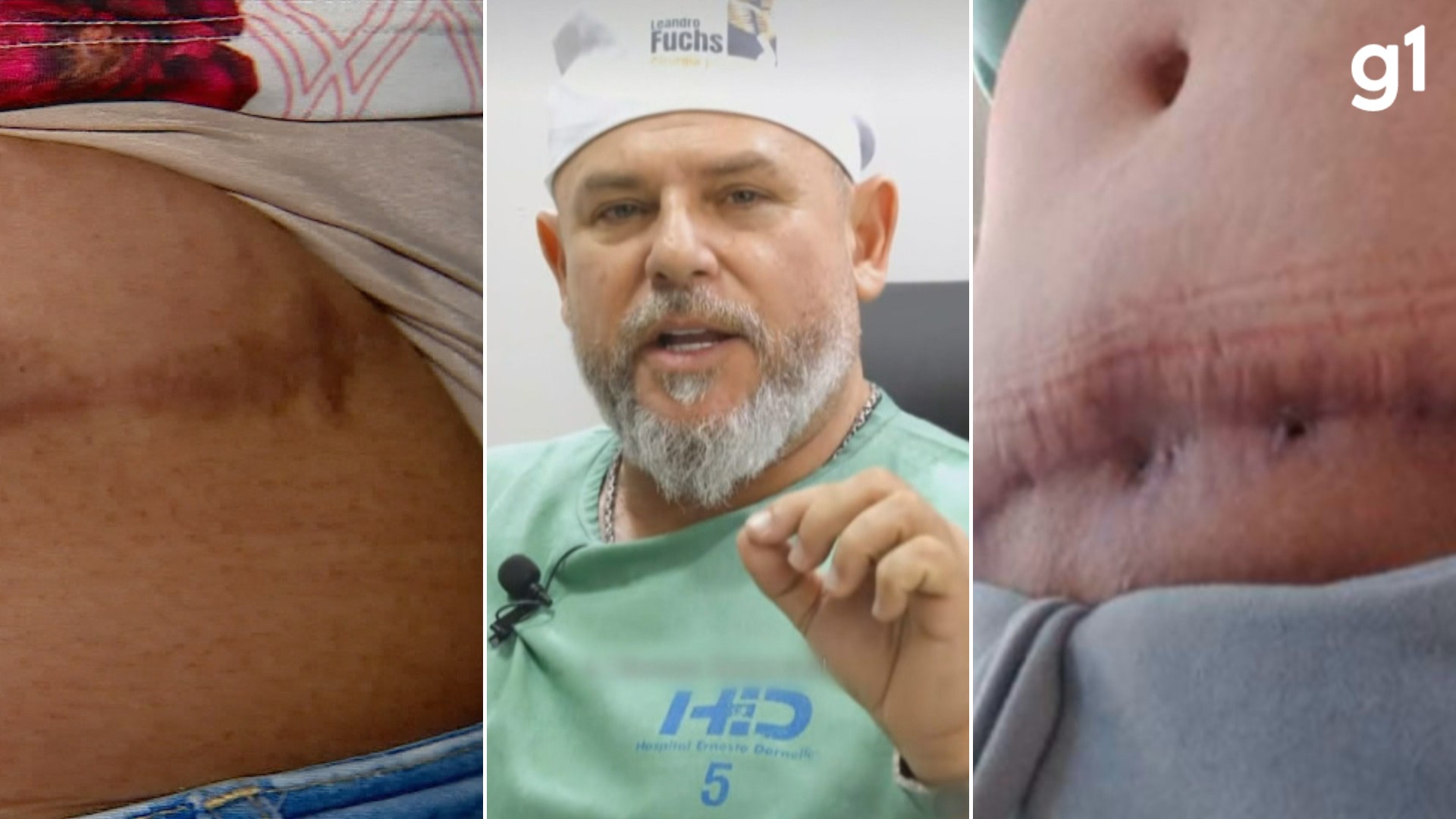 Justiça torna réu cirurgião plástico Leandro Fuchs por crimes contra pacientes no RS