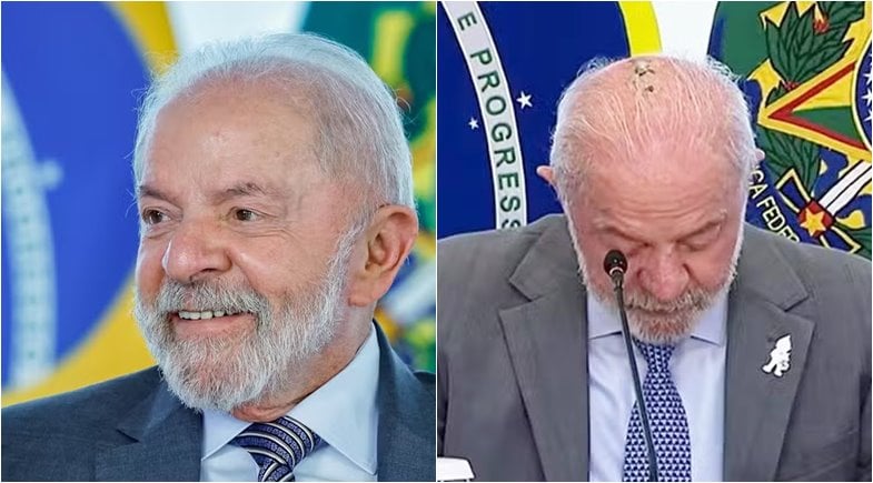 Presidente Luiz Inácio Lula da Silva encerra radioterapia e declara estar curado de câncer de pele
