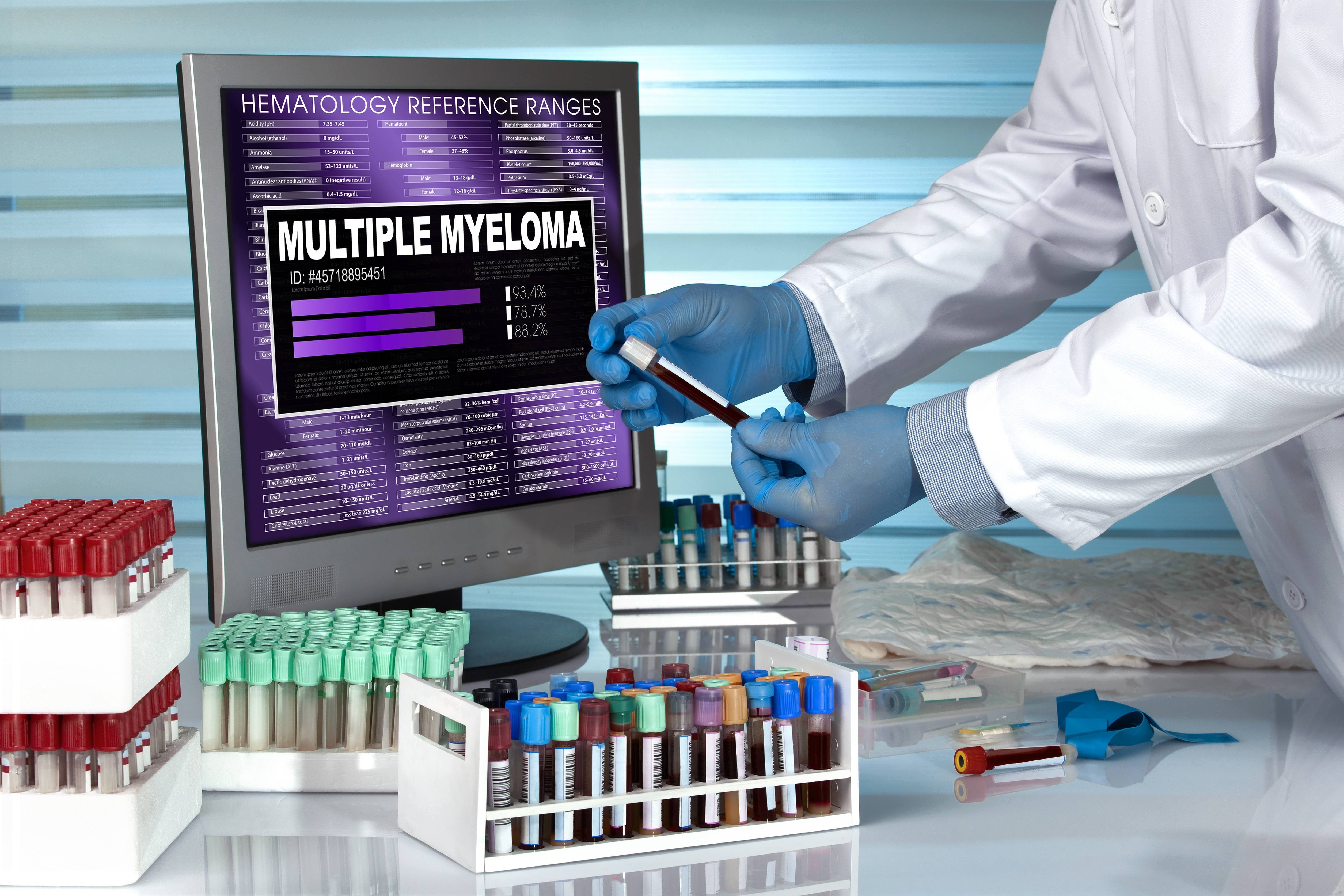 Estudo propõe novo critério para identificar casos graves de Mieloma múltiplo