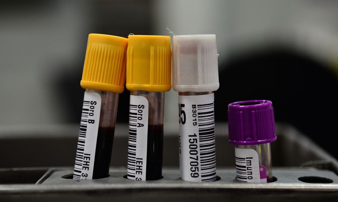 Molécula reduz danos por infarto em testes com RATOS realizados na Unicamp