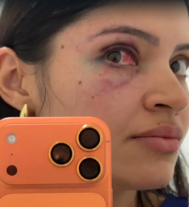 Homem é preso após agredir e sufocar esposa em Parnamirim