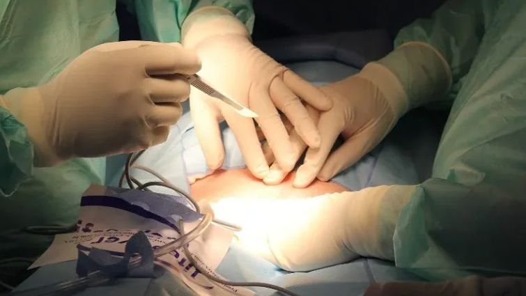STJ determina que plano de saúde arque integralmente com cirurgia de feminização facial para mulher trans