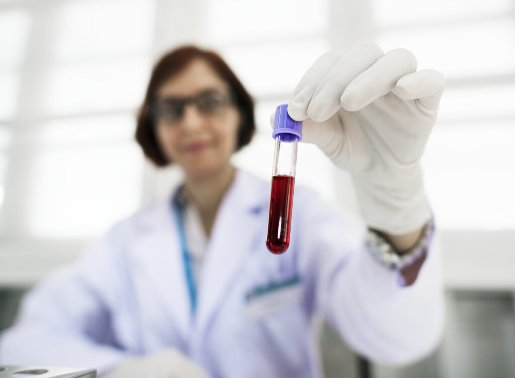 Nova terapia de edição genética corta colesterol ruim após uma aplicação