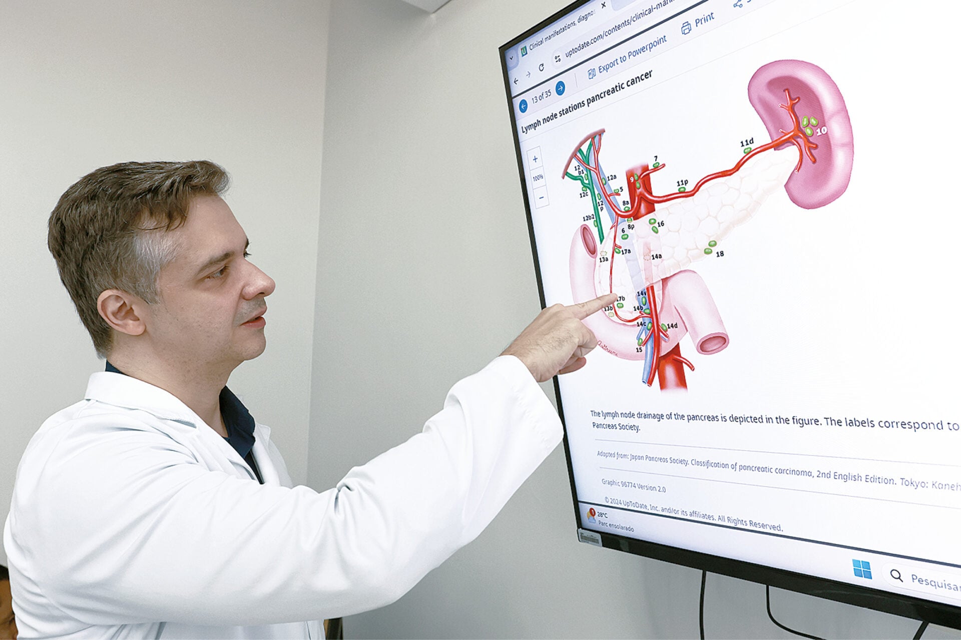Novo comprimido dobra sobrevida de pacientes com câncer de pâncreas metastático, aponta estudo