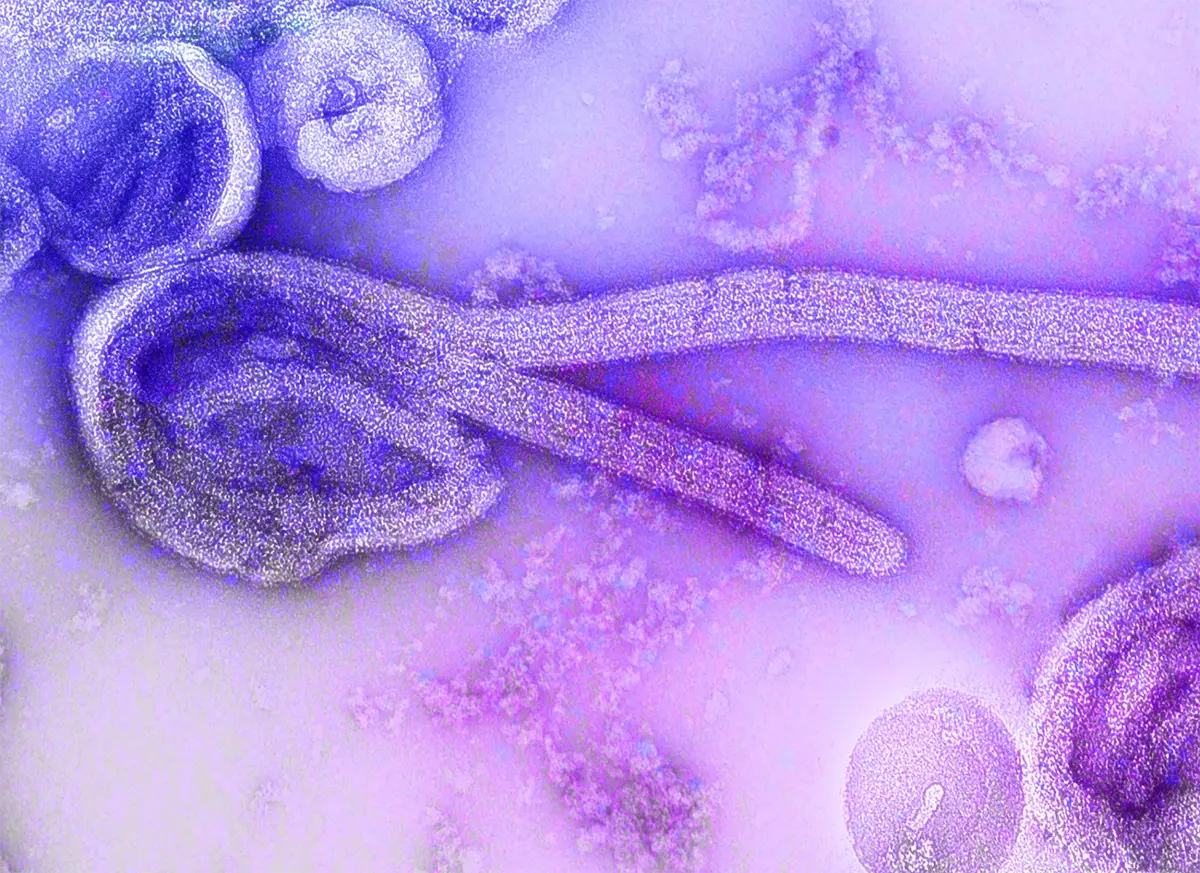 Paciente de Uganda com sintomas suspeitos de Ebola testa positivo para malária no Rio de Janeiro