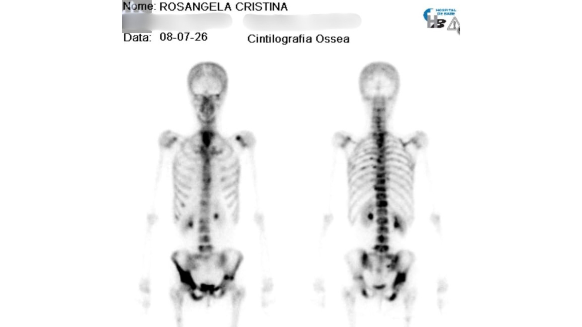 Professora de Guapiaçu, SP, redefine a vida após diagnóstico de estágio paliativo