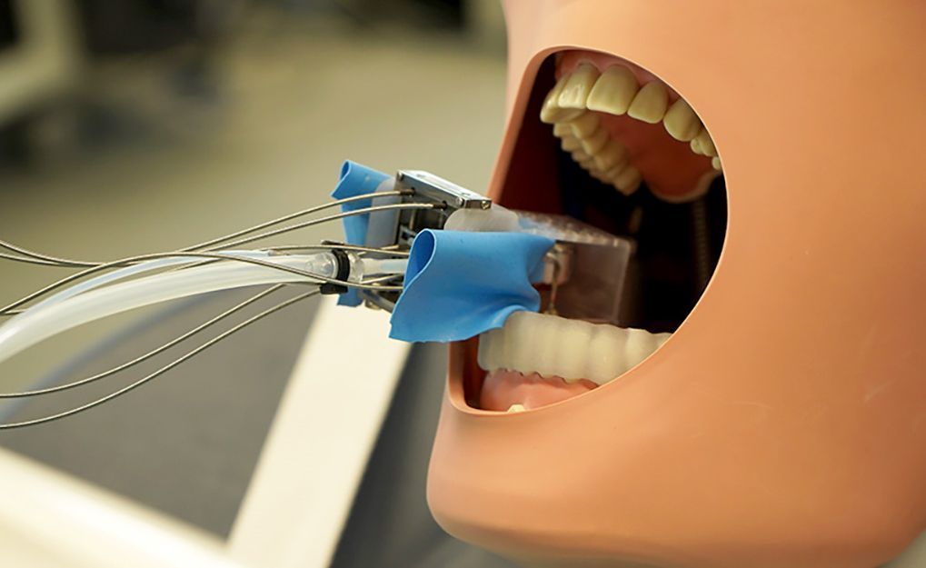 Robô em miniatura revoluciona preparo dentário para coroas
