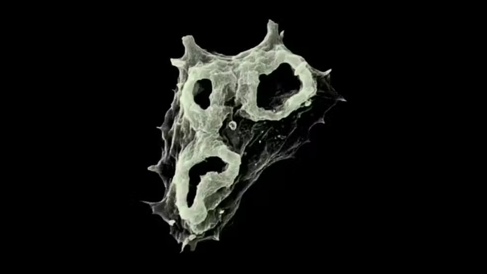 Entenda os riscos e as formas de prevenção contra a Naegleria fowleri