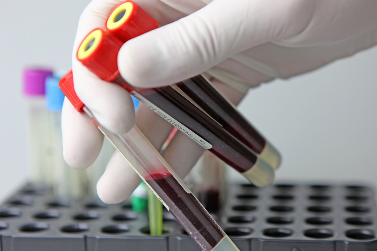Cientistas do Reino Unido: Exame de sangue prevê doenças graves