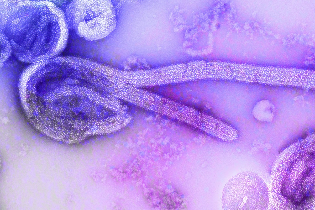 Organização Mundial da Saúde atualiza números alarmantes do surto de Ebola na África