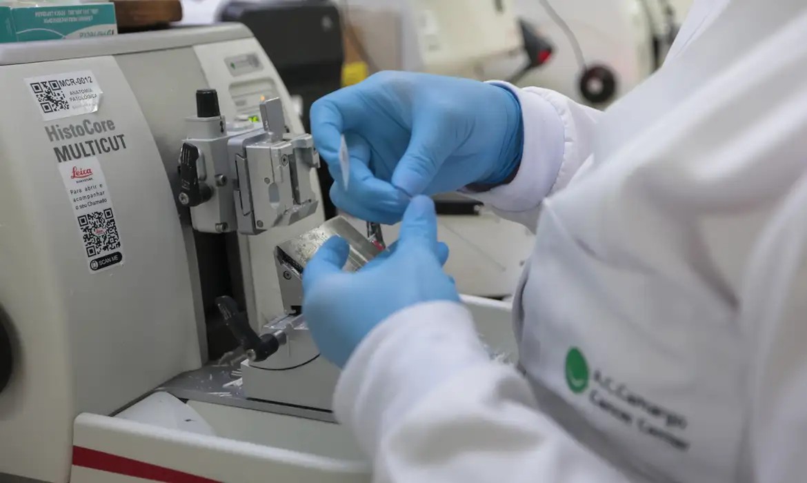 Ministério da Saúde incorpora nova terapia para leucemia mieloide aguda em adultos no SUS