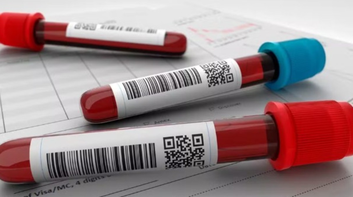 SUS incorpora venetoclax e azacitidina para tratar leucemia mieloide aguda em adultos